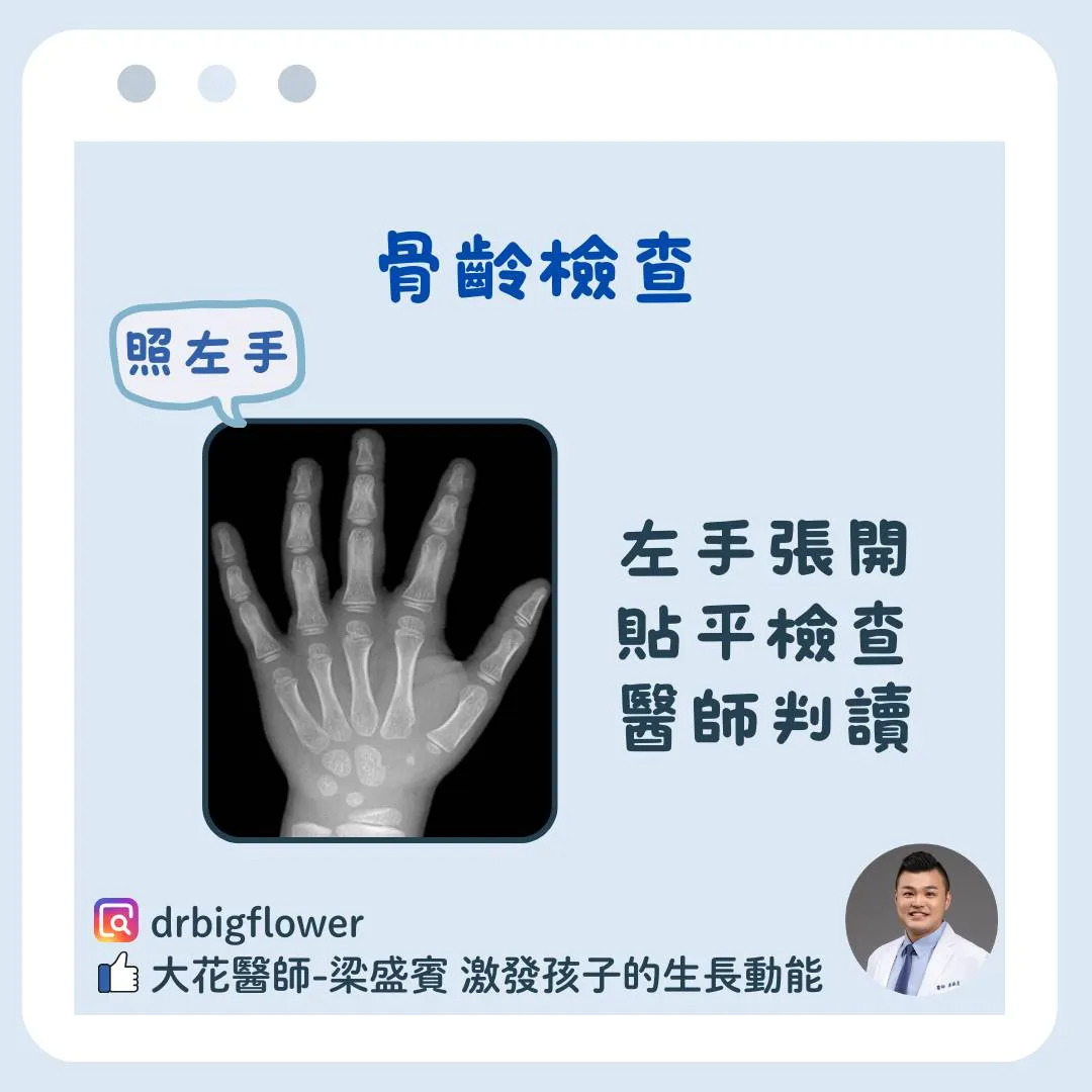 骨齡檢查X光示意圖